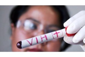 análisis sida VIH- Télam
